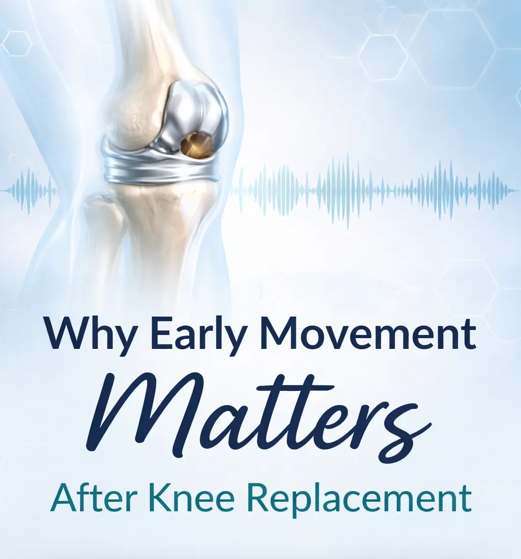 Why early movement matters after knee replacement